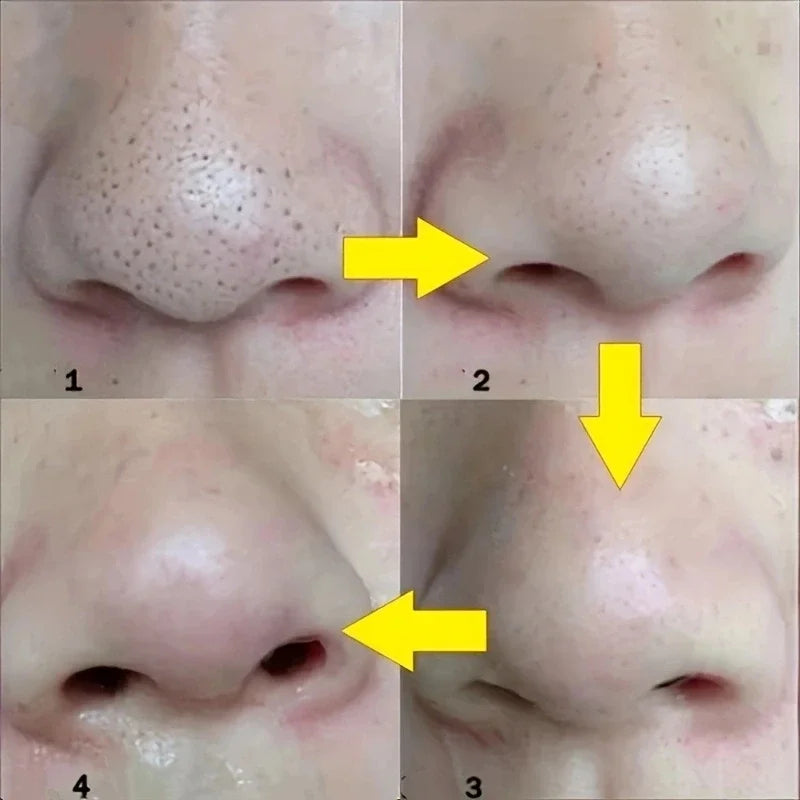 Deep Cleansing Nose Strips with Bamboo Charcoal (10/20/50PCS